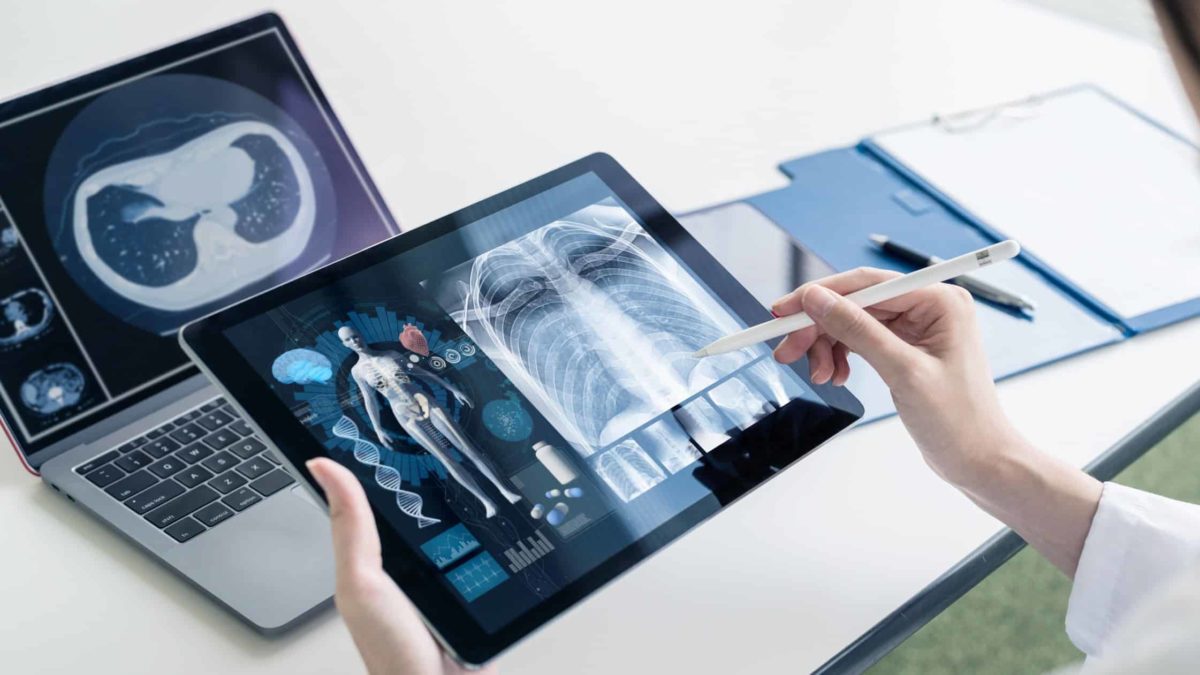 X-ray being viewed on a tablet and laptop