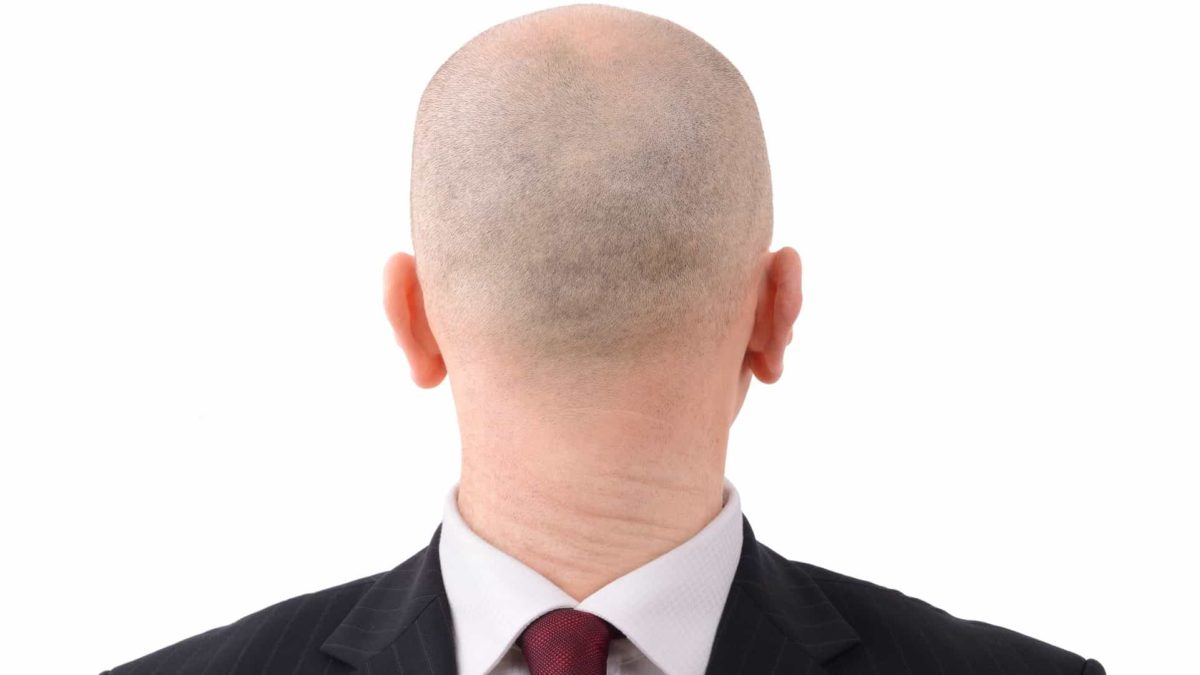 man facing backwards and dresssed back to front representing fortescue share price going backwards