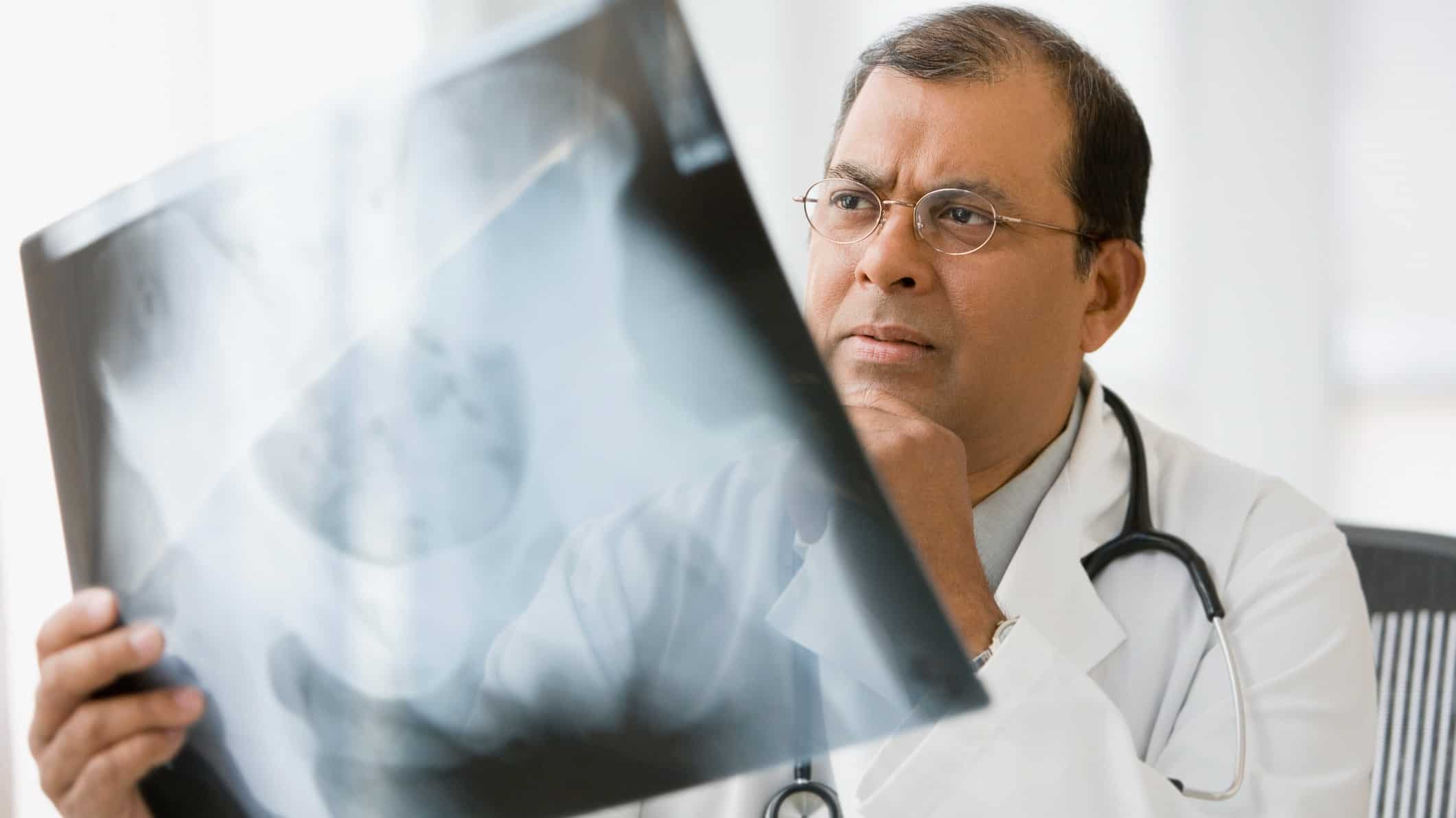 a concerned medical doctor examines an Xray from an imaging machine in a hospital setting.