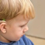 a young boy in profile shows the cochlear implant devide fitted to his ear and attached to the side of his head to help him to process sounds.
