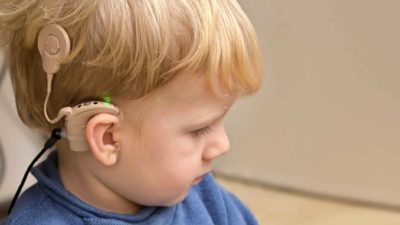 a young boy in profile shows the cochlear implant devide fitted to his ear and attached to the side of his head to help him to process sounds.